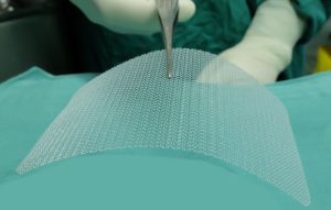 siatka do wszczepienia